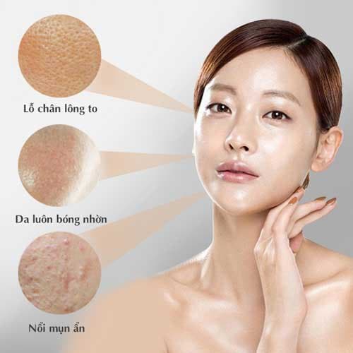 Top 5 Kem Chống Nắng Cho Da Dầu Mụn Đáng Mua Nhất 2026